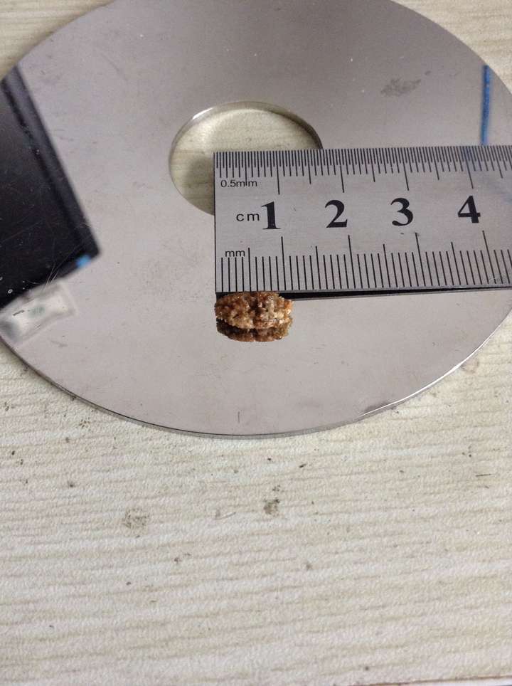 肾结石排石时一般多大会有痛感