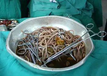 吃蔬菜沙拉(生蔬菜)究竟会不会得寄生虫病?