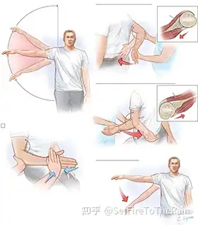 肩袖损伤的典型症状是肩部疼痛,肩关节肿胀以及肩关节活动受限.
