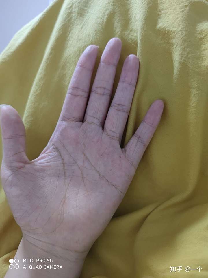 年纪轻轻23岁手上皮肤就很干有很多皱纹像老年人干瘪的手怎么办呀