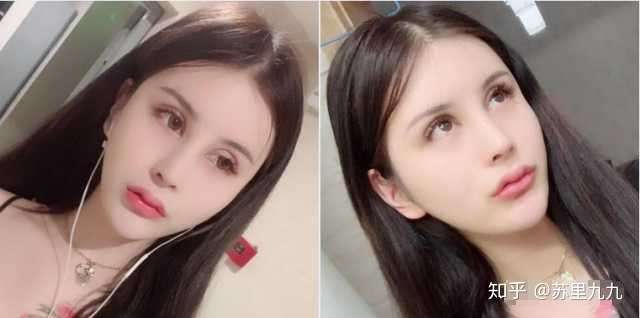 为什么整容一眼就能看出来? - 知乎