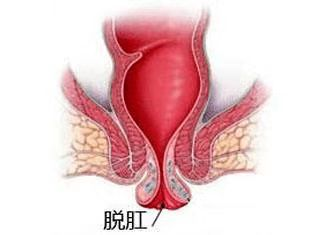 广州东大肛肠医院收费正规吗难受，为什么肛门总是湿湿的？