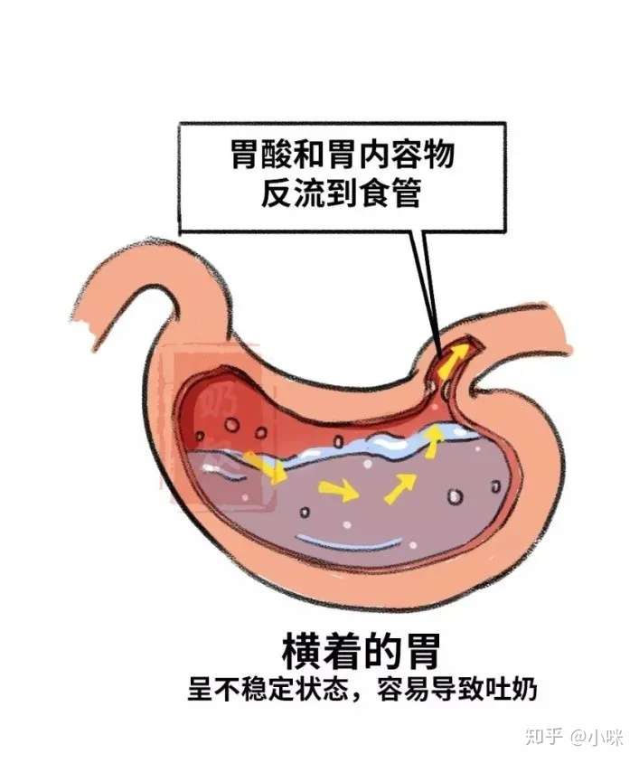 千万要当心 宝宝经常干呕 吐奶 很可能得了这种病 知乎