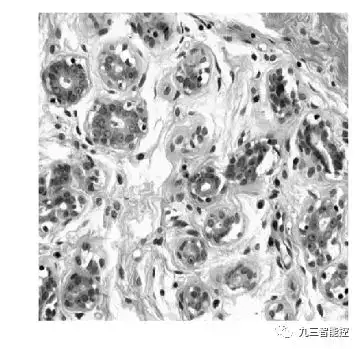 算法集锦(5)|医学图像的边缘检测|Python_边缘检测方法分割医学图像图-CSDN博客