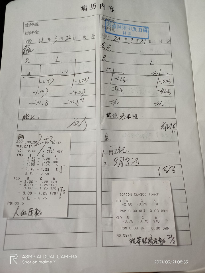 从医院的单据来看右眼175度近视,125度散光轴位5,矫正视力0.8.