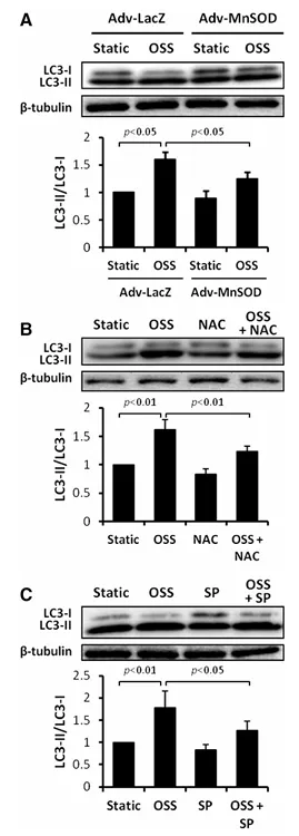 紊亂血流誘導(dǎo)自噬并損傷自噬流以擾亂線粒體穩(wěn)態(tài)