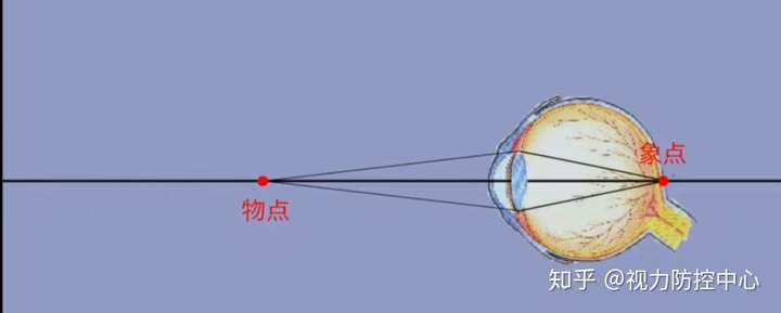 孩子近視了它真的可以保你無憂嗎