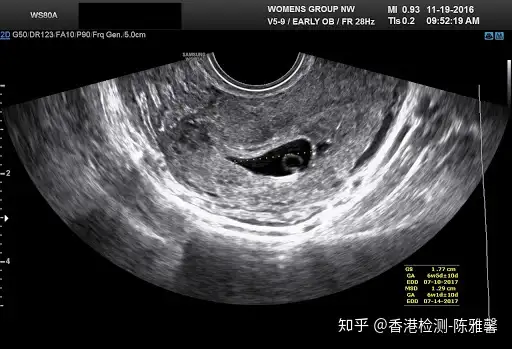 怀孕 生男还是生女 传说中的 土 方法全是坑 知乎