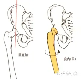 股骨扭转式骨骼自身的旋转,即骨的转动,而髋部内旋是在髋关节骨骼之间