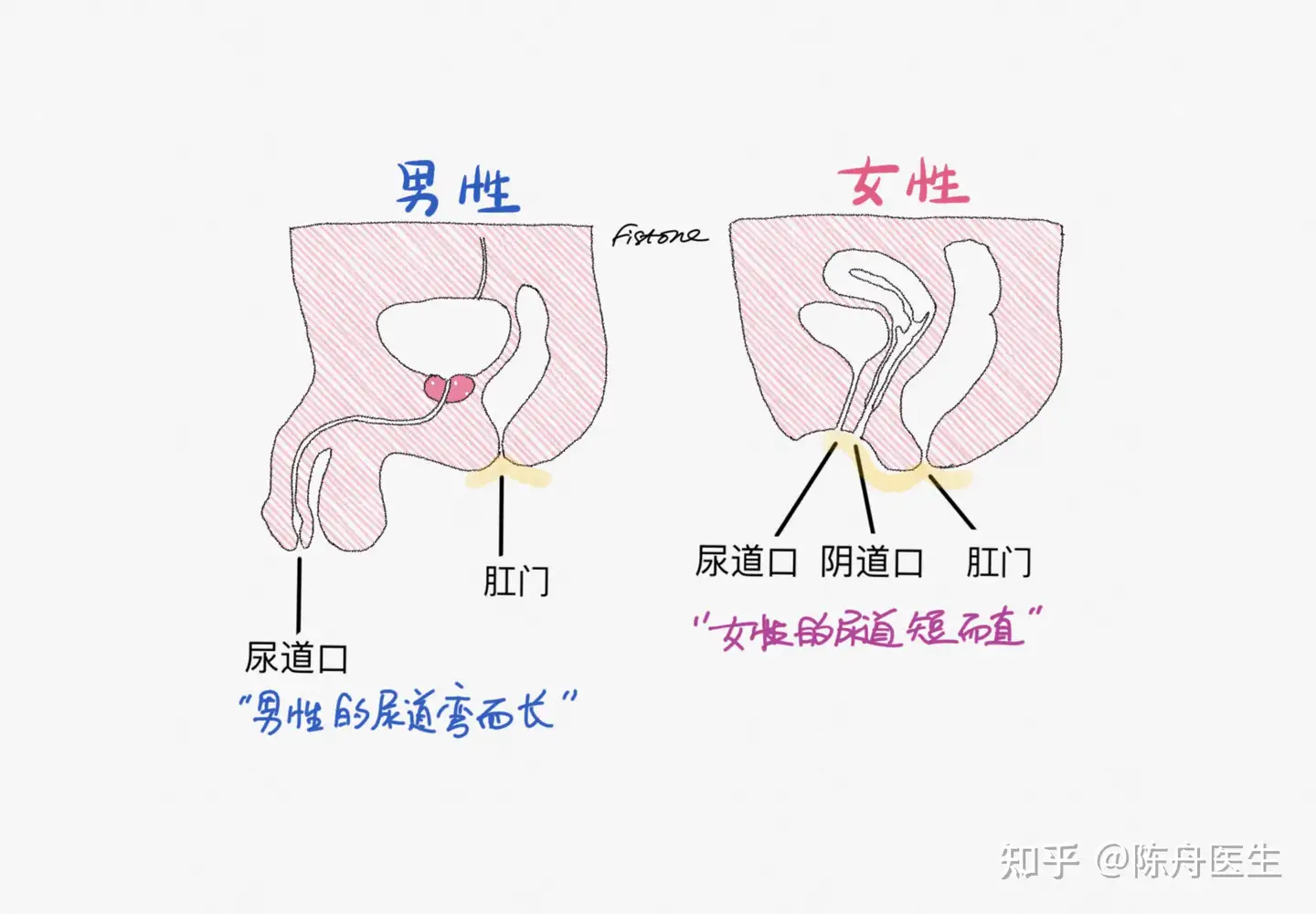 XXOO后要不要马上尿尿？这个男女有别！ - 知乎