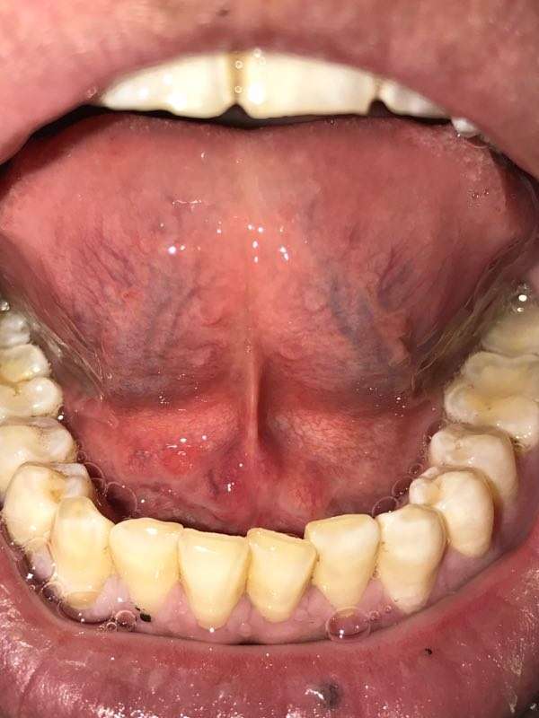 舌底照片图片