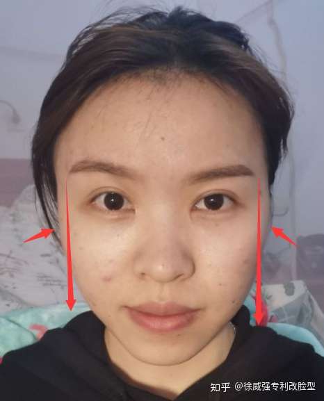 我的颧骨很高吗?外扩吗? - 知乎