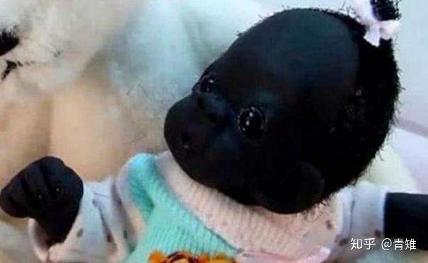 当年被称作是最黑婴儿因为肤色一夜爆红5年后长成怎么样了