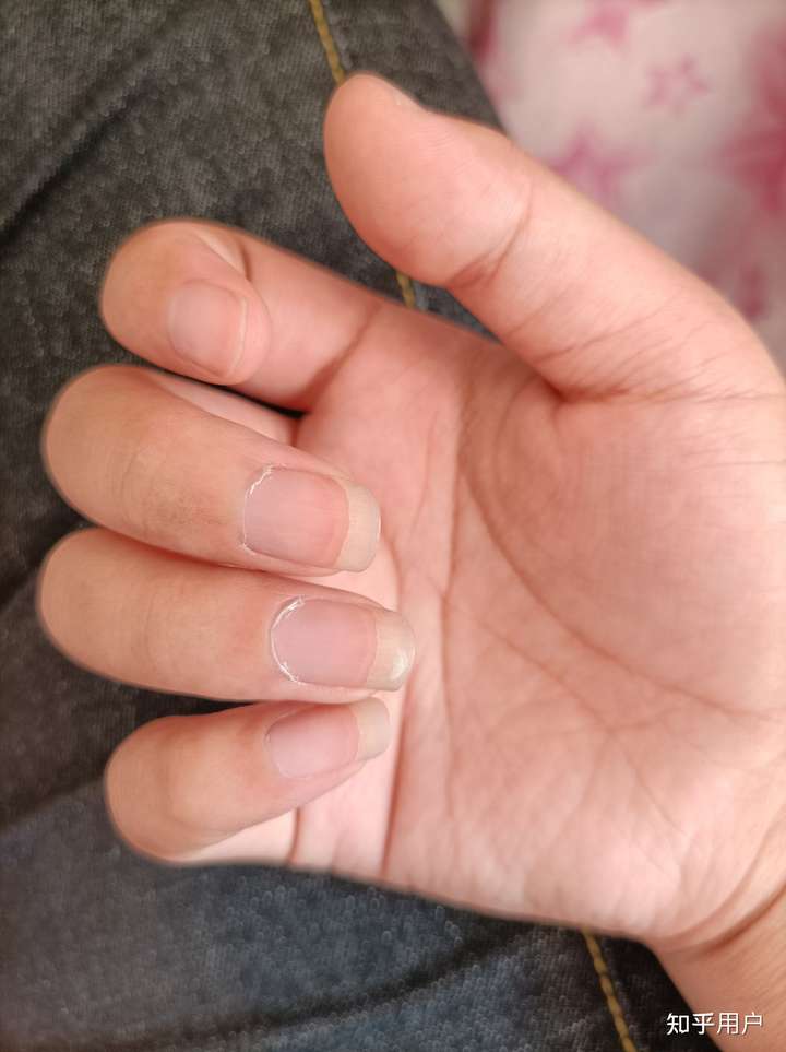 我的指甲太宽了,有什么方法能使指甲看上去细长好看点?