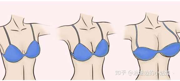 自体脂肪隆胸随着年龄变大胸会变小吗