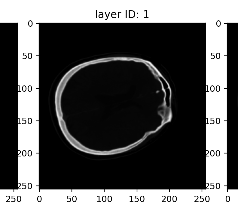 Nii File Python python 与 JavaScript 读取并可视化 CT 图像 (.nii & .nii.gz)