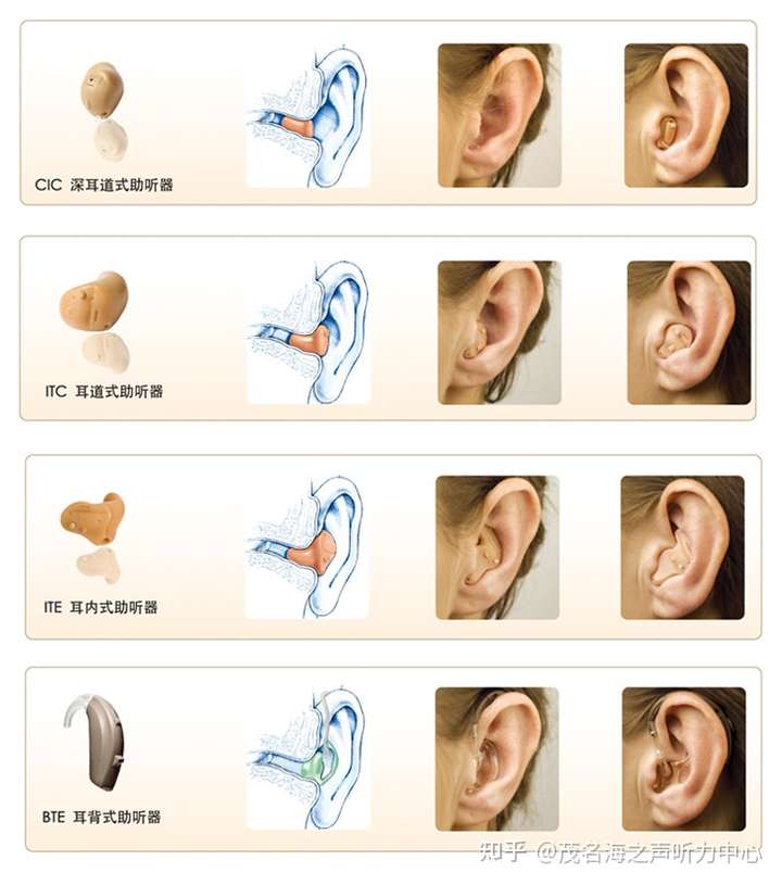 助聽器戴一個可以嗎?