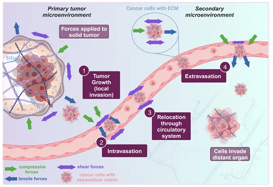 癌癥力學(xué)生物學(xué)的進(jìn)展:轉(zhuǎn)移、力學(xué)與材料 癌癥力學(xué)生物學(xué)的進(jìn)展:轉(zhuǎn)移、力學(xué)與材料