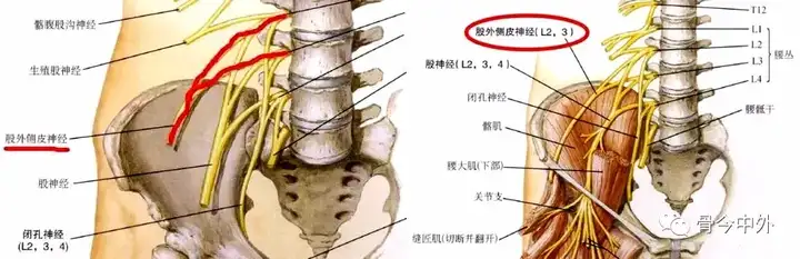 腰骶关节的上下缘,腰骶关节劳损插图10 腰骶关节的上下缘,腰骶关节劳损插图10