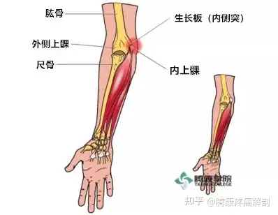 概述4 人贊同了該文章騰康疼痛解剖