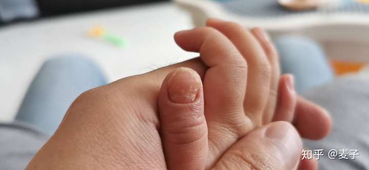 求鉴定这是什么引起的指甲问题