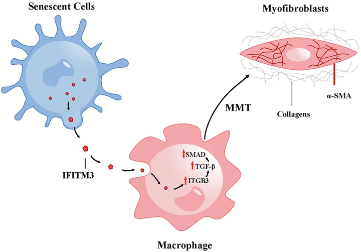 慢性缺血性腎病中細(xì)胞衰老促進(jìn)巨噬細(xì)胞向肌成纖維細(xì)胞的轉(zhuǎn)變
