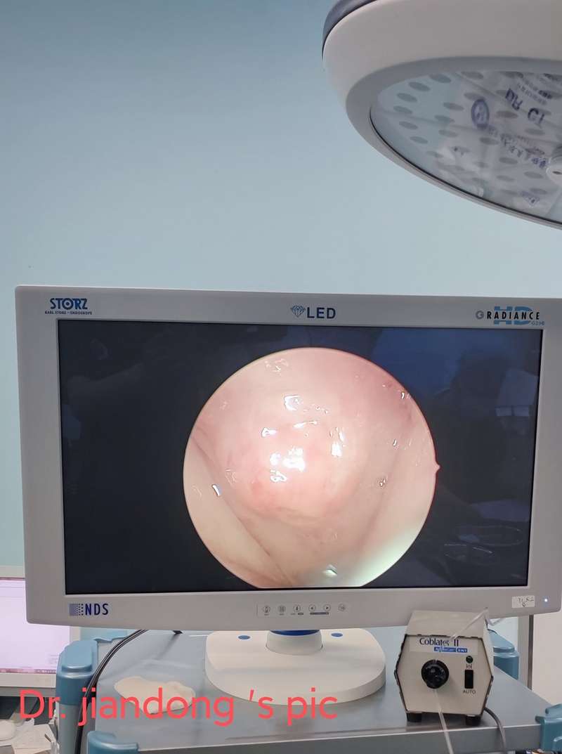 李健东大夫 的想法: 咽囊炎,一般是成年人,鼻咽顶部原来#腺… - 知乎