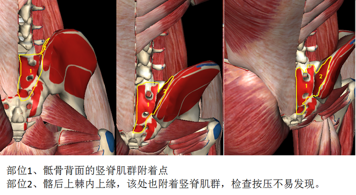 竖脊肌附着位置为骶骨背面和骶髂关节处的髂后上棘内上缘,如