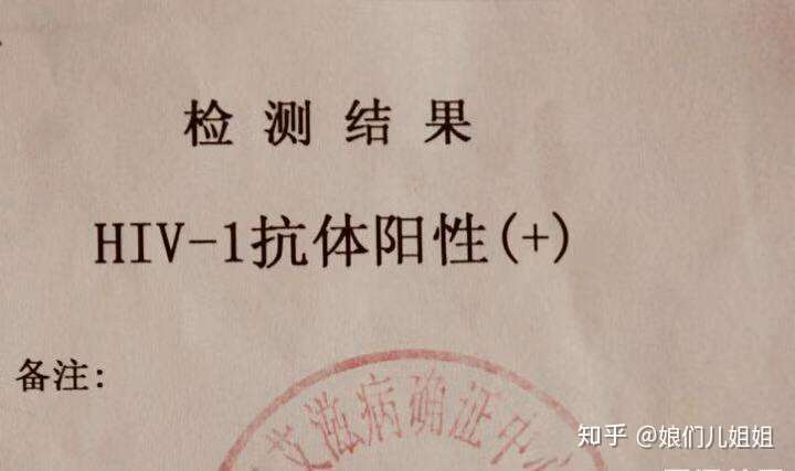 hiv抗体和人体免疫缺陷病毒抗体是同一种东西吗