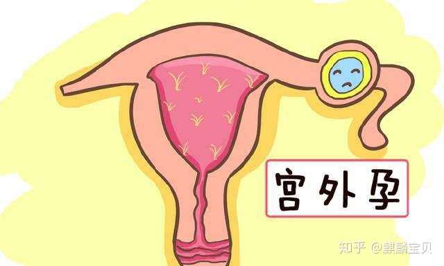 引发宫外孕,输卵管为何从来不讲武德?插图(2) v2-1dc6115707baf05979f718d3377ff7c8_720w.jpg插图(2)