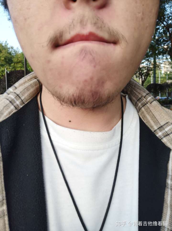 想问一下,怎么才能有又浓密又硬又黑的胡子呢?