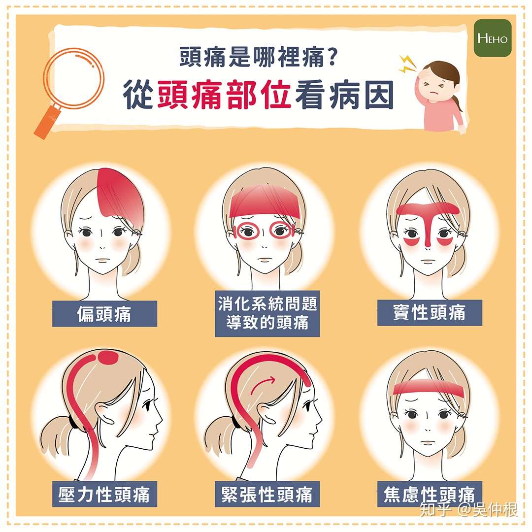 头痛怎么办 原因有哪些 何时必须就医 医师完整解说 知乎