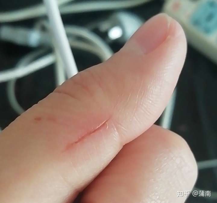 被不足四个月的小猫牙齿刮伤出血