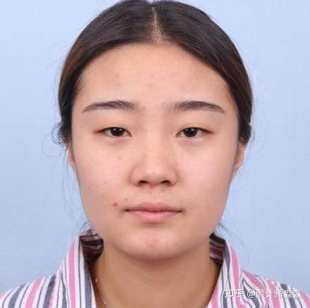 三角眼 肿泡眼 内双 这种眼睛怎么变好看?