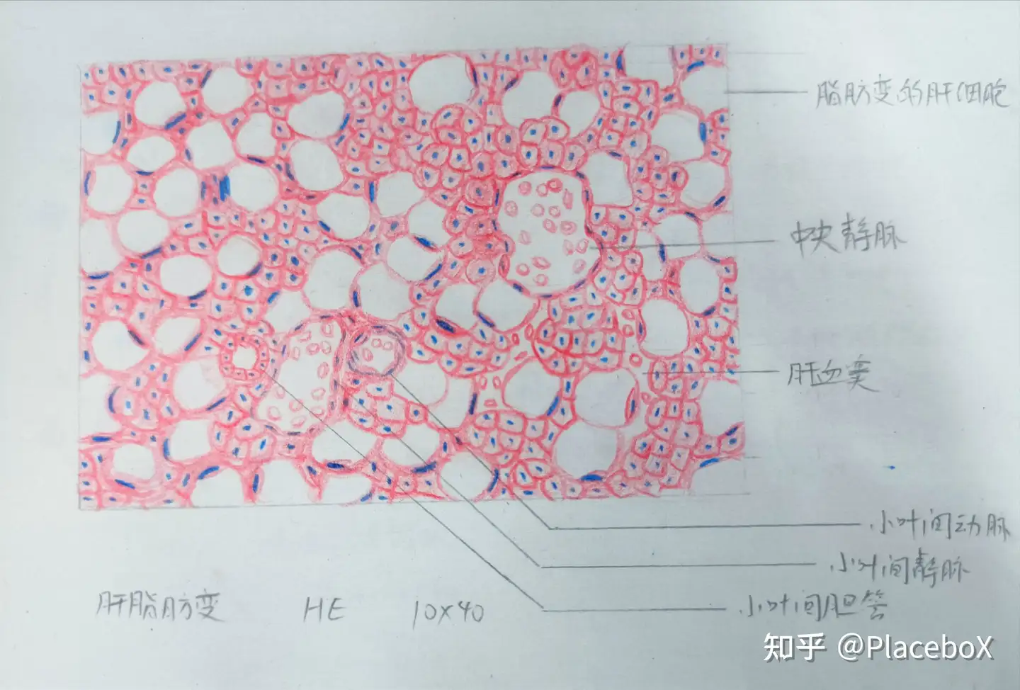 病理学实验红蓝铅笔绘图】细胞的适应，损伤与修复- 知乎