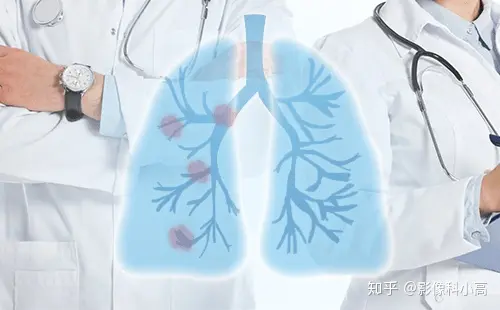 肺癌转移到淋巴会有哪些症状？