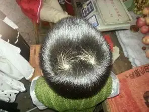 宝宝头顶有几个发旋这和性格智力有关系吗