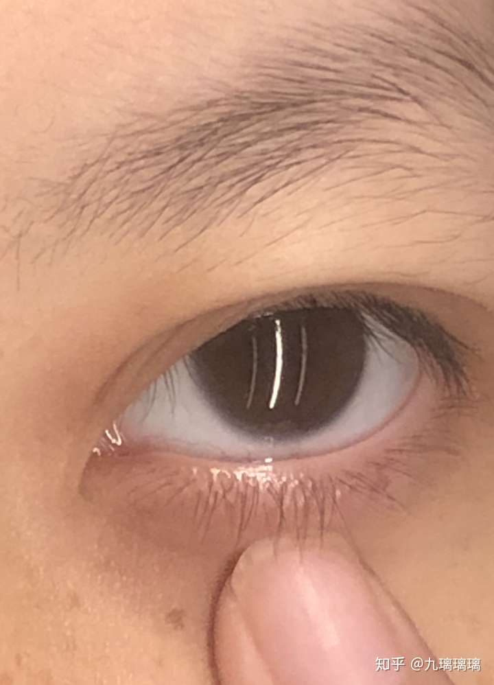 下眼睑的睫毛特别长会怎么样/是一种什么样的体验?