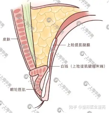 kiss法双眼皮的原理