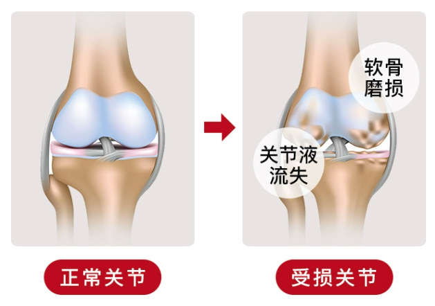 除了了解氨糖软骨素价格多少钱一盒，还更应该知道这些