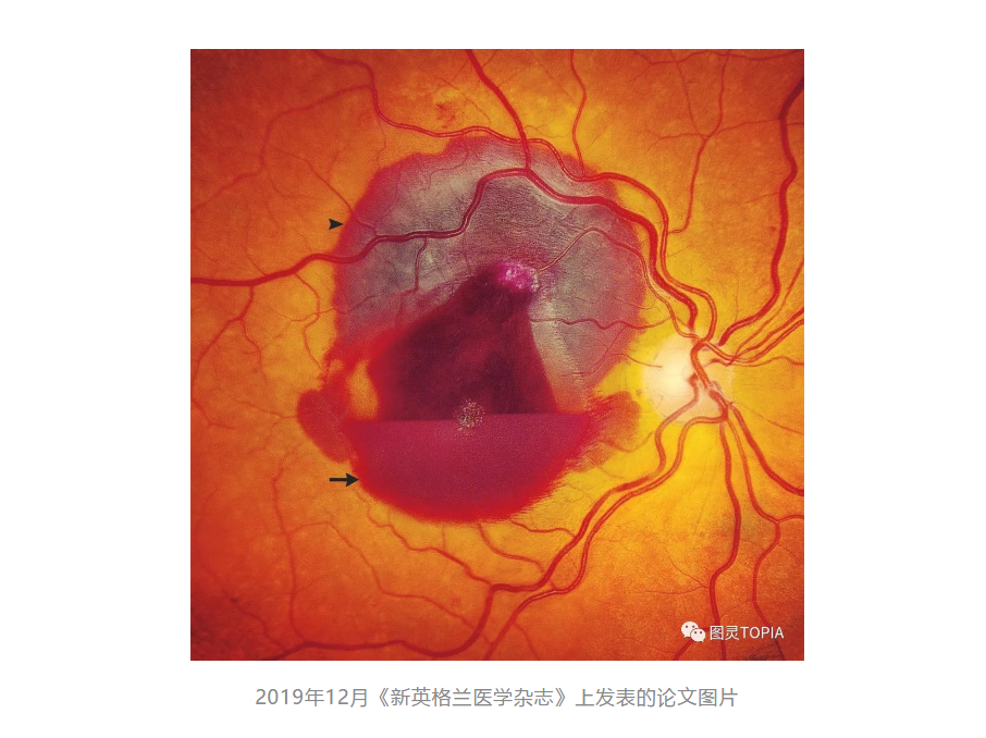 令人窒息的操作 顶刊医学论文竟然剽窃期刊封面图 知乎