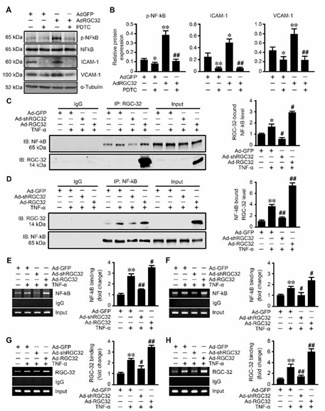 RGC-32 缺失可保护内皮细胞免受炎症损伤并减轻动脉粥样硬化 RGC-32 缺失可保护内皮细胞免受炎症损伤并减轻动脉粥样硬化