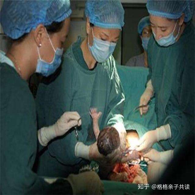 女人剖腹产两次还能再剖腹产生孩子吗?