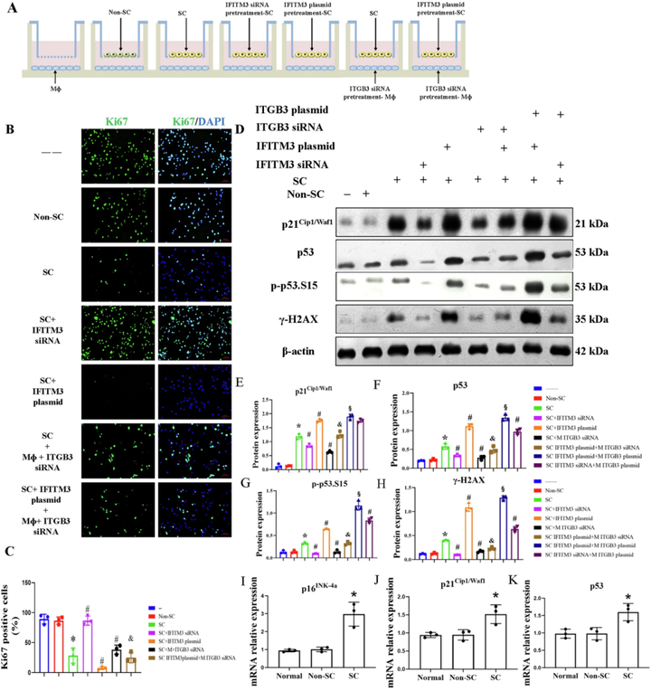 慢性缺血性腎病中細(xì)胞衰老促進(jìn)巨噬細(xì)胞向肌成纖維細(xì)胞的轉(zhuǎn)變