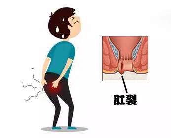 佛山肛泰肛肠医院好不好？肛裂便血怎么办？