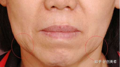 显胖的嘴边肉 应该如何甩掉 知乎