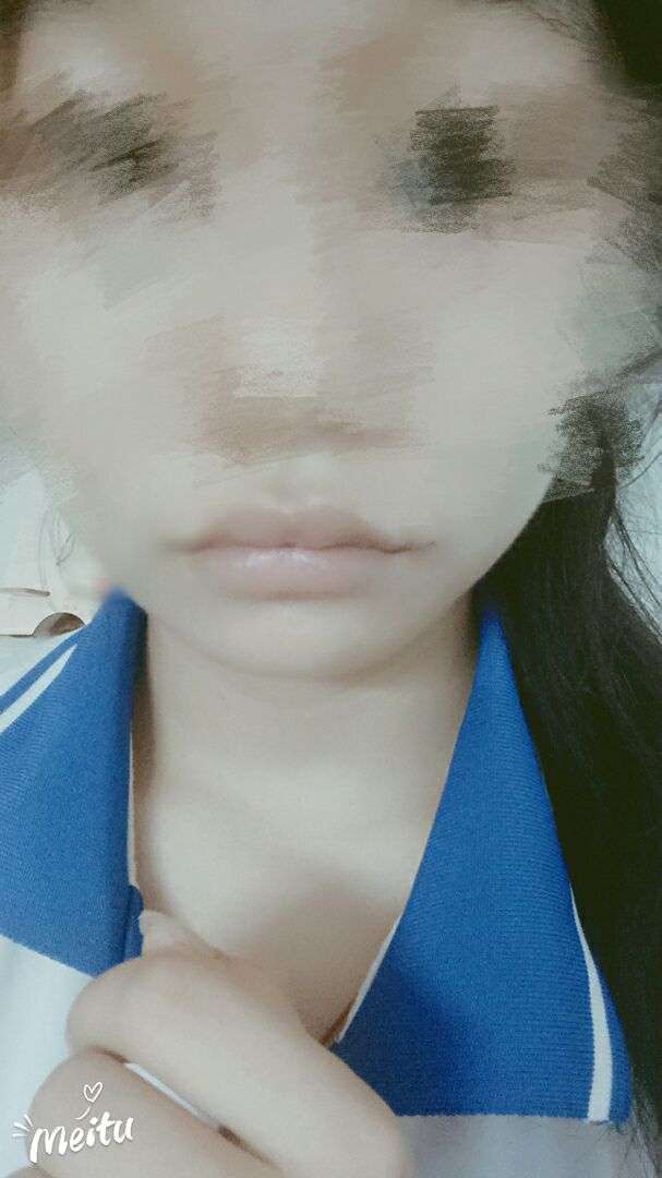 嘴巴难看是一种怎样的体验?