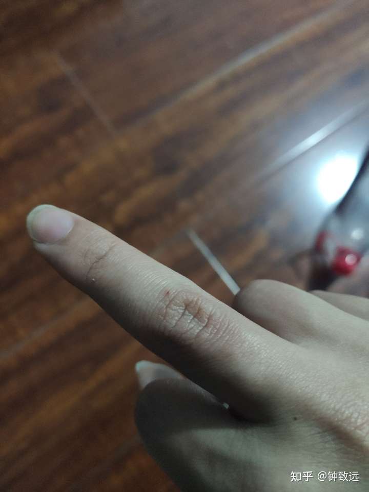 昨天晚上被流浪猫抓伤伤口很小几乎看不见但是渗出一点血需不需打疫苗