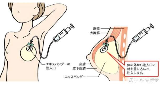 重建女性的魅力 知乎