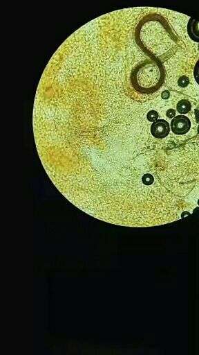 微生物学 这是中华大蟾蜍的血细胞的标本,我很疑惑黑色是气泡吗?